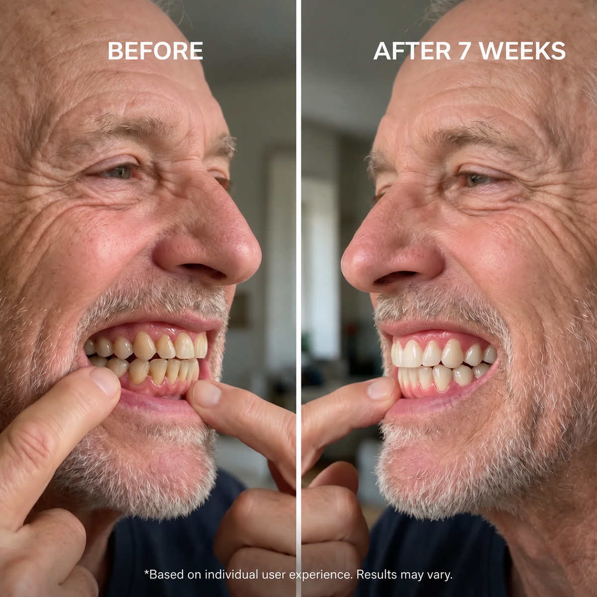 Restore Your Smile's Health in 12 Minutes a Day